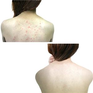 ���奻�ʡ�2�ܥ��åȡ�