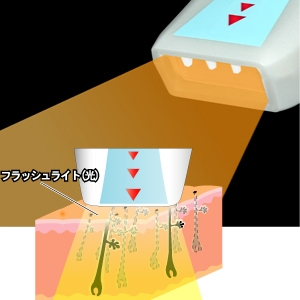 �磻�ɥǥԥ졼�����ӡ���