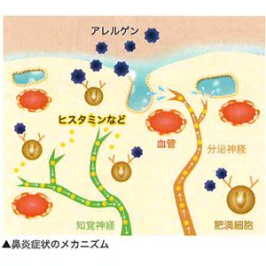 SUKKIRI-KUN�ʥ��å��ꥯ���